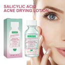 OUHOE Salicylic Acid Acne Drying Lotion Salicylic Acid Deeply Removes Acne Repair Facial Moisturizing Hydrating Serum