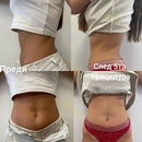 The Myoelectric Forge | NEO RF EMS Body Sculpting & Electromagnetic Muscle Stimulator