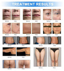 The Architect of Renewal | 7D HIFU Facial Sculpting & Body Contouring Platform