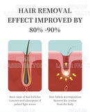 The Photon Edge | 808nm Diode Ice Titanium Laser Hair Removal System