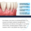 Gums Essence Effectively Relieve Tooth Allergy Dental Caries Tooth Cleaning Toothpaste Relieve Tooth Damage Drops 2026 New