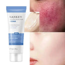 Facial Redness Repair Cream Sensitive Skin Dryness Moisturizer Hydrating Sooth Serum Lotion  Removal Rosacea Skin Care Ointments