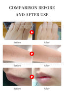 The Photon Edge | 808nm Diode Ice Titanium Laser Hair Removal System