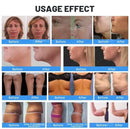The Apollo Duet | Dual-Handle Ultrasonic Cavitation & RF Skin Tightening Console