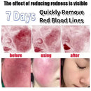 Facial Redness Repair Cream Sensitive Skin Dryness Moisturizer Hydrating Sooth Serum Lotion  Removal Rosacea Skin Care Ointments