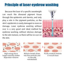 est Sellers Laser Beauty Machine Portable Q-switch ND YAG Laser Tattoo Removal Pigmentation Removal Carbon Peeling Machine