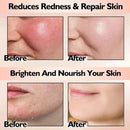 Facial Redness Repair Cream Sensitive Skin Dryness Moisturizer Hydrating Sooth Serum Lotion  Removal Rosacea Skin Care Ointments