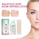 OUHOE Salicylic Acid Acne Drying Lotion Salicylic Acid Deeply Removes Acne Repair Facial Moisturizing Hydrating Serum
