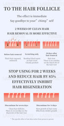 The Photon Edge | 808nm Diode Ice Titanium Laser Hair Removal System