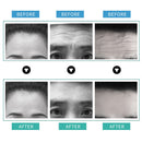 Ilisya Forehead Furrow Patch Anti-wrinkle Line Removal Stickers Frown Lines Hydrogels Anti-aging Moisturizng Patch Skin Care